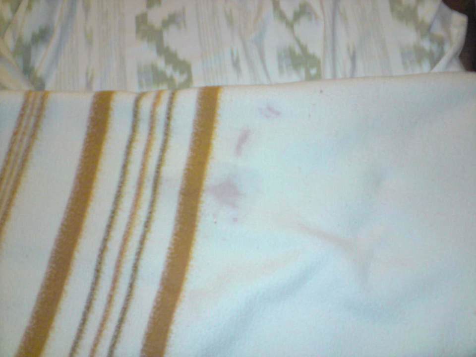 Fleckige Decken Som Suret Hotel