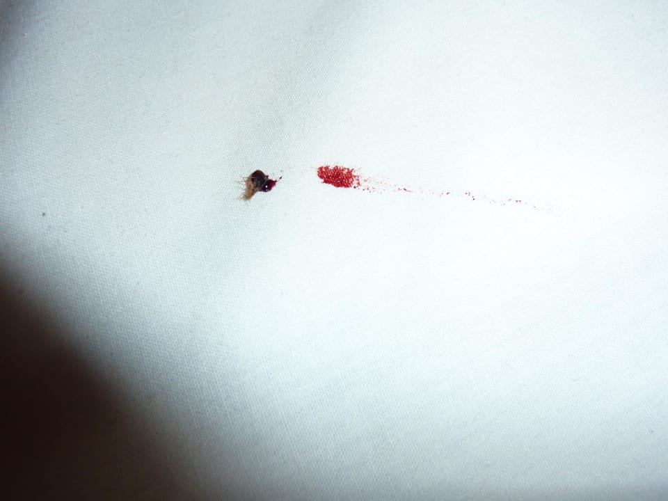 Bettwanze erwischt ca. 4:00 früh Sandies Bathala Maldives