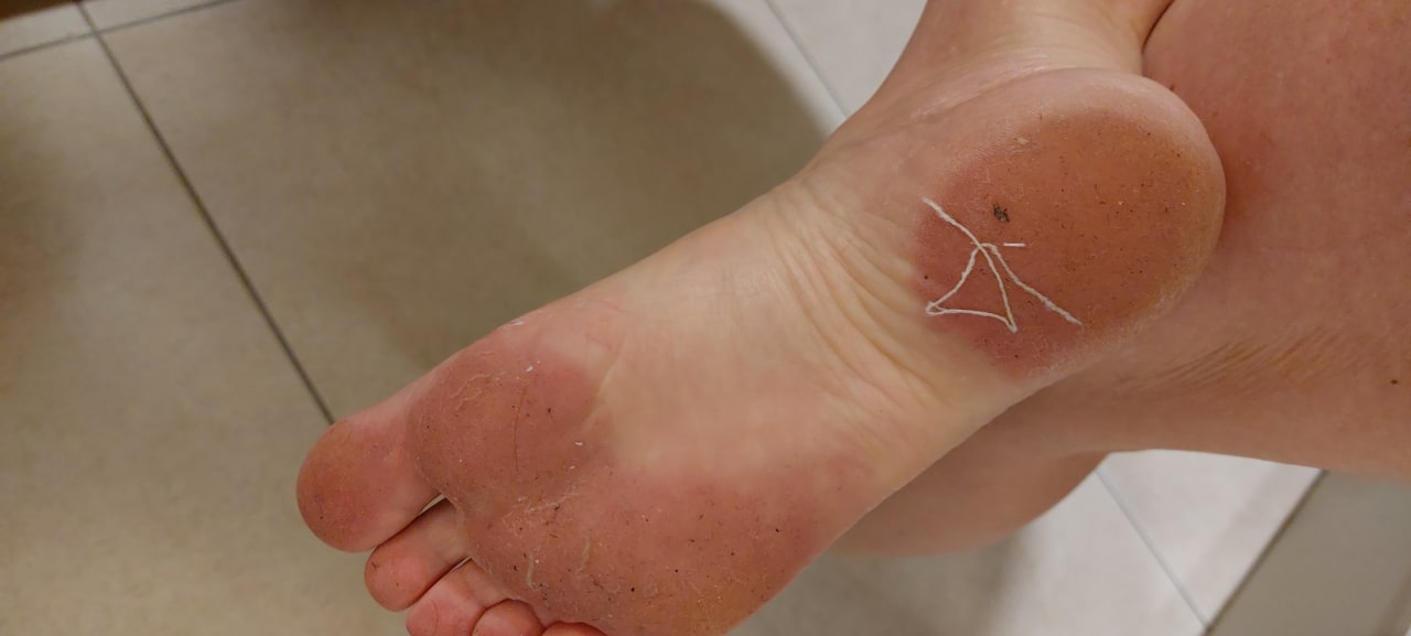 Zimmer Well Palace Side