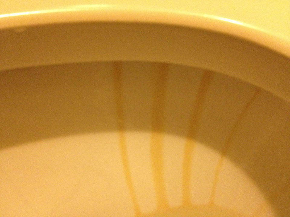 Toilettenrand  Postcard Inn Beach Resort & Marina @ Holiday Isle