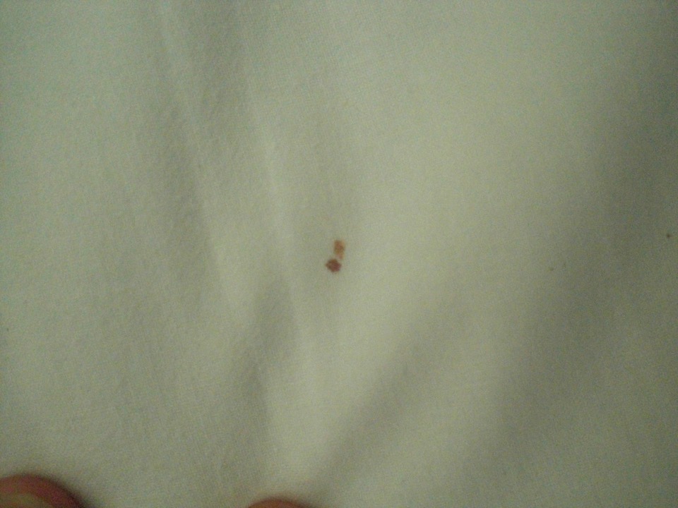 Blutfleck auf der anderen seite des Kissens Valentin El Patriarca Varadero