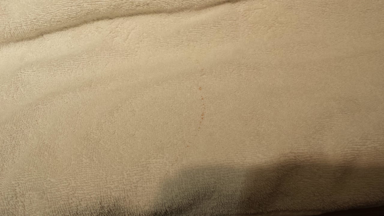 Das dreckige Handtuch, es sind wohl Blutflecken Atlantica Mikri Poli Crete