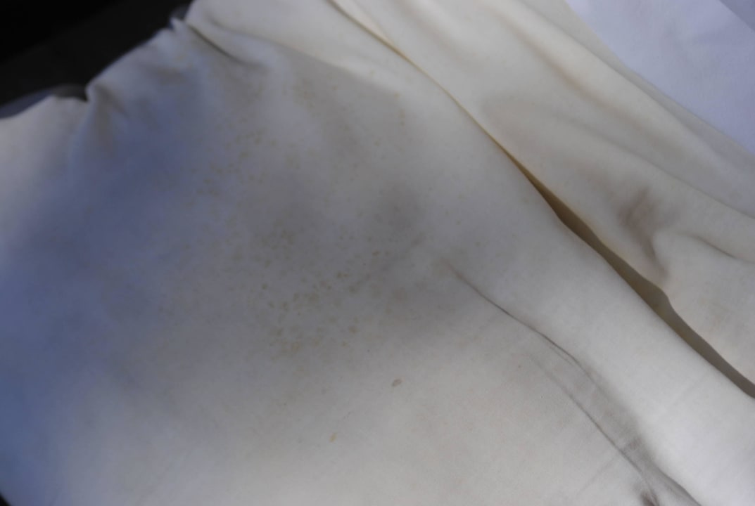 Schimmel überall sogar auf dem Kopfkissen Grand Yazici Club Marmaris Palace