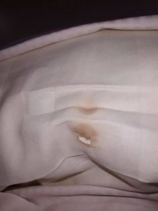 Brandfleck im Kissen Hotel Valkenhof