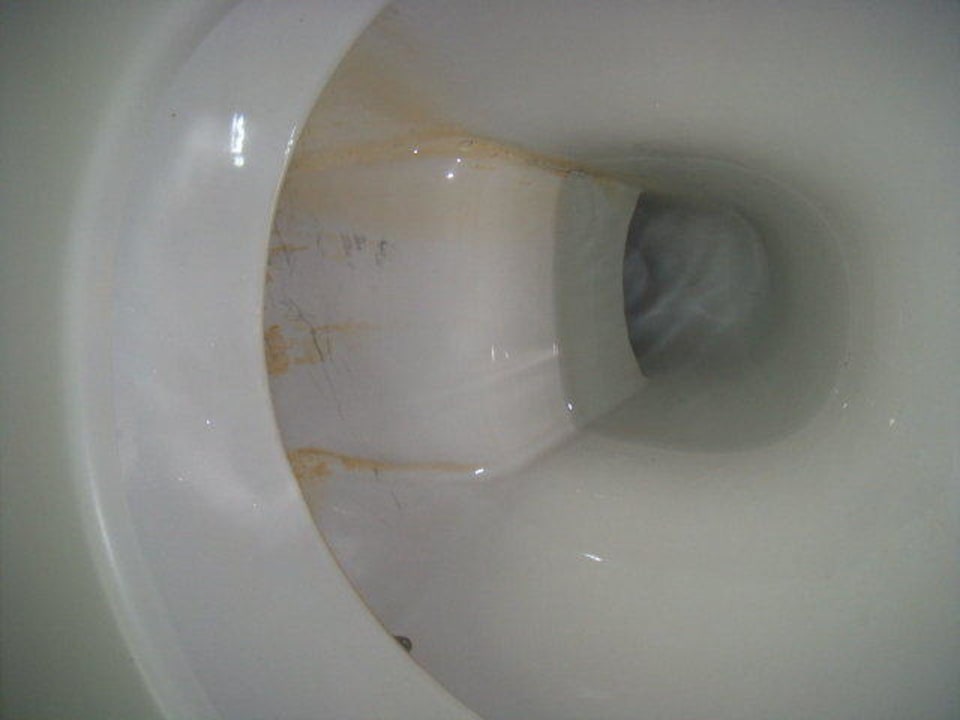 Abstoßend verfärbte Toilette Opera Hotel Köln