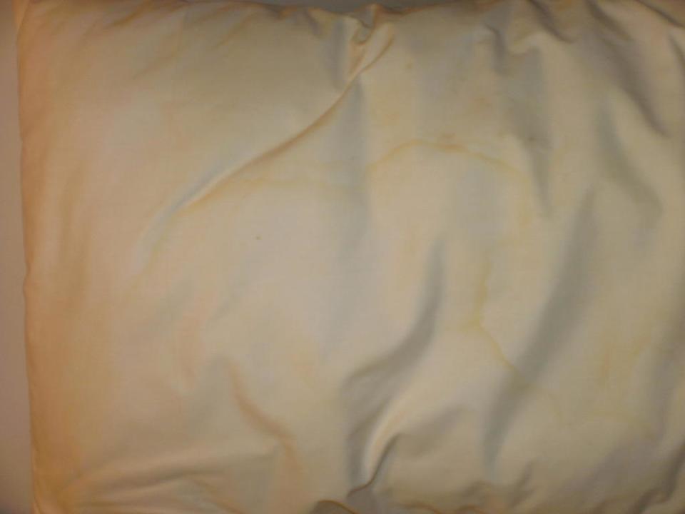 Verdreckte Kopfkissen Pinnacle Lumpinee Park Hotel