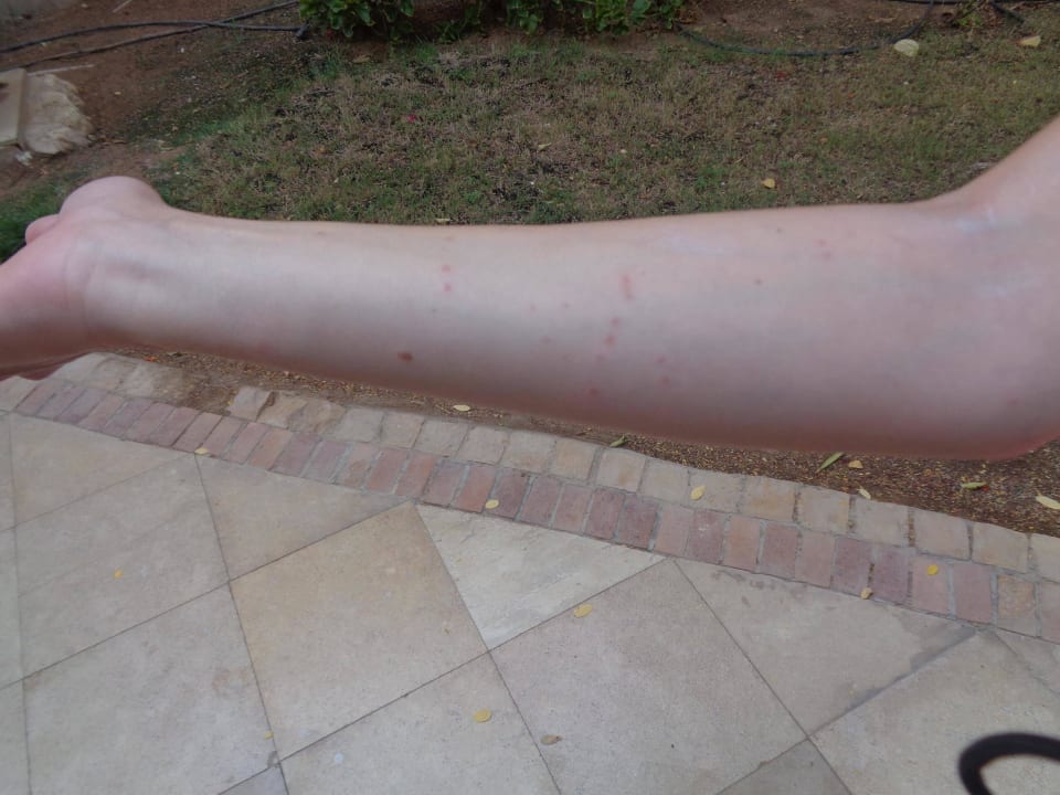 Укусы рыбок The Grand Hotel Sharm El Sheikh