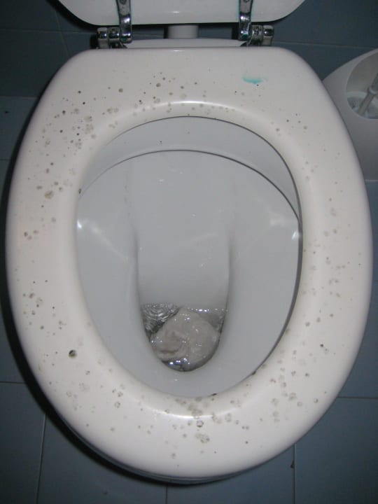 WC-Sitz mit Schimmel bedeckt Centro Vacanze La Limonaia