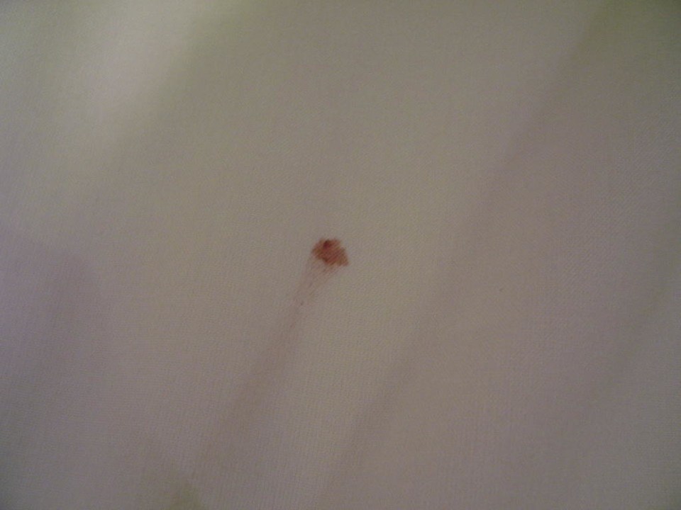 Blutflecken auf dem frischen Laken Alassio Hotel and Thalasso