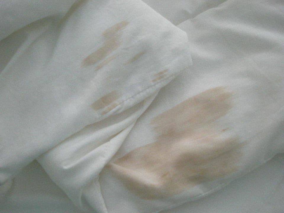 Ersatzdecke mit großen Flecken. Hive Khaolak Beach Resort