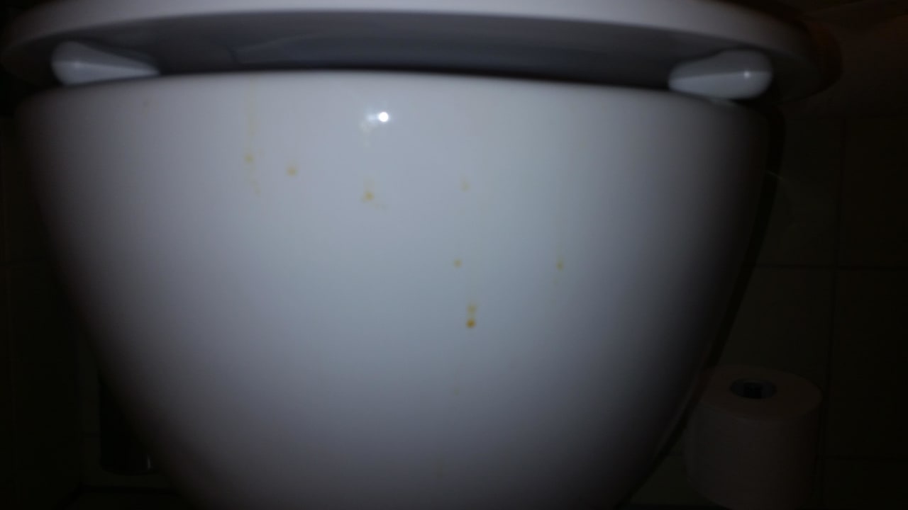 Urinflecken Toilette  Park Plaza Berlin