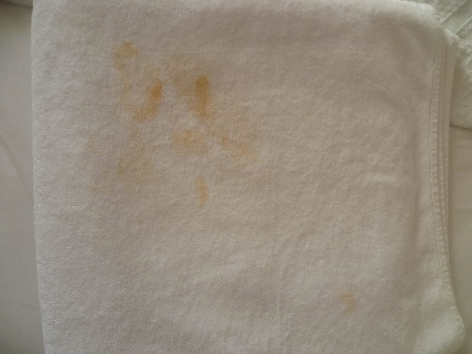 Undefinierbare Flecken in den Handtüchern Hatipoglu Beach Hotel