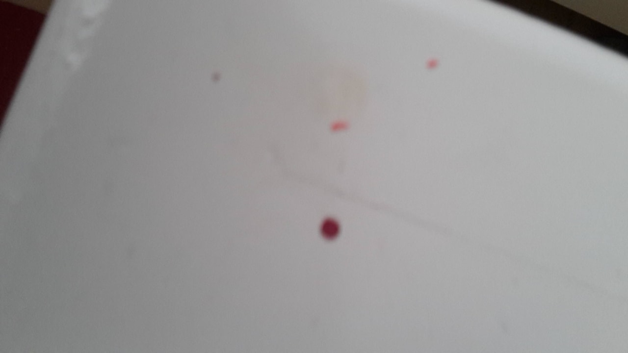 Blut auf dem Nachtschrank Royal Karthago Djerba