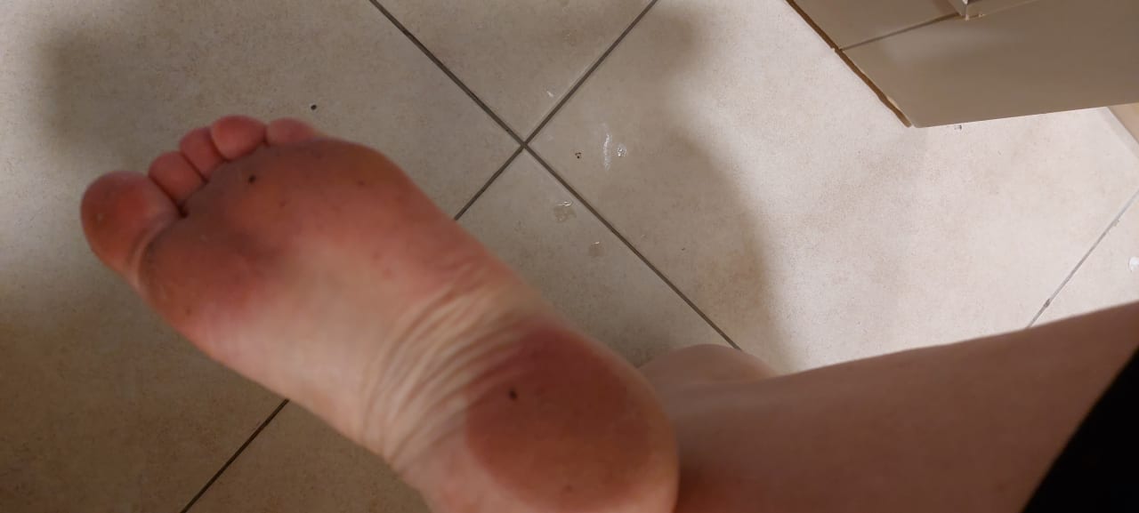 Zimmer Well Palace Side