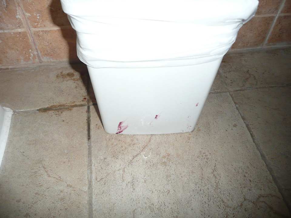 Flecken (Blut?) auf dem Mülleimer Sharm Resort
