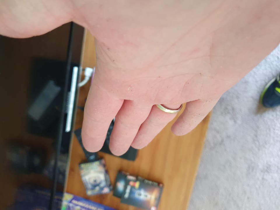 Sonstiges Landal Beach Resort Ooghduyne