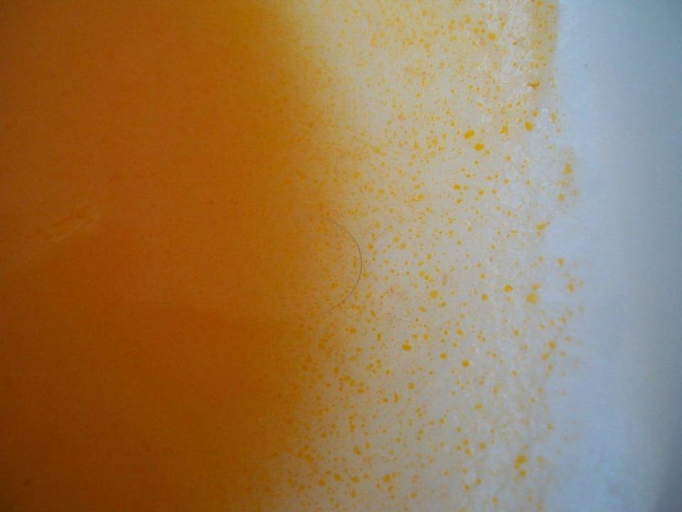Haar in der Suppe Hotel Akropol