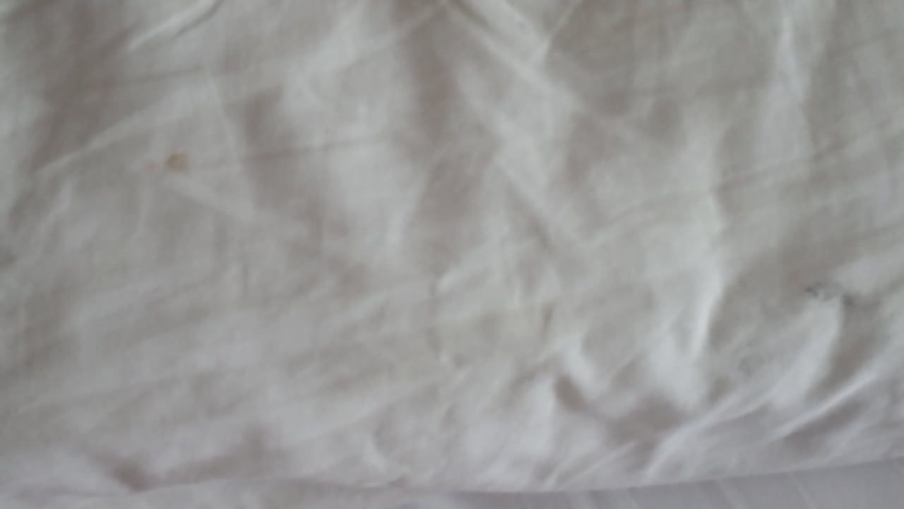 Flecken auf der Bettwäsche Hotel Exe Vienna