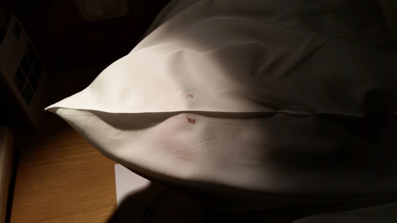 Blutflecken auf dem Zimmer bei Ankunft Holiday Inn Express Frankfurt - Airport