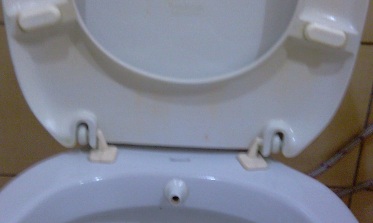 Urinflecken an der Toilette Prestige Alanya