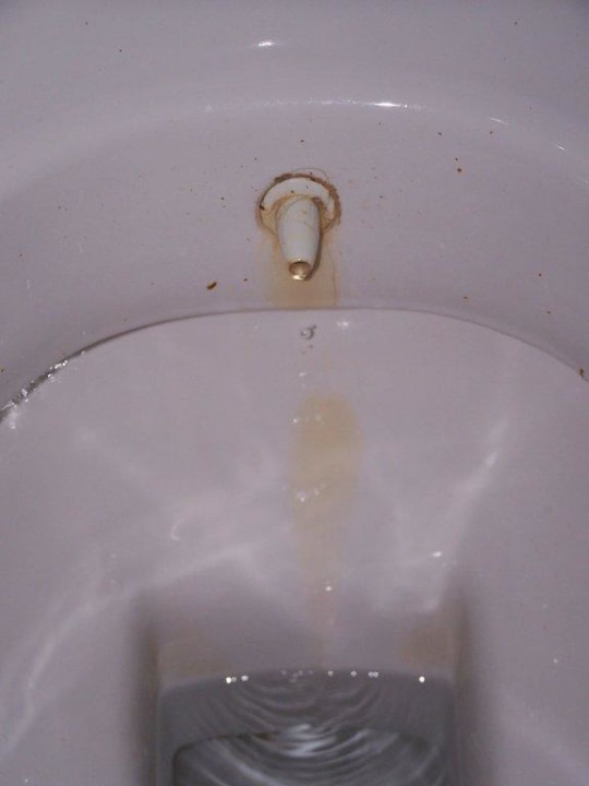 Das Klo Hotel Asrin Beach