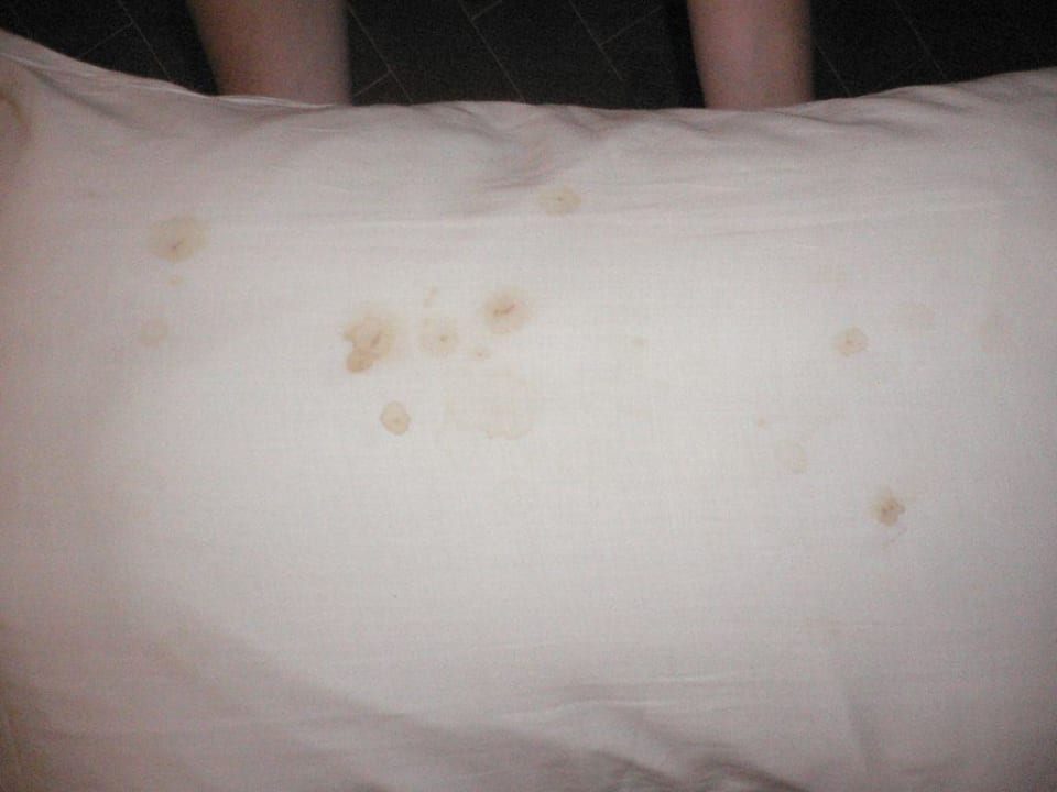 Blutflecken auf Kissen allsun Hotel Carolina Mare