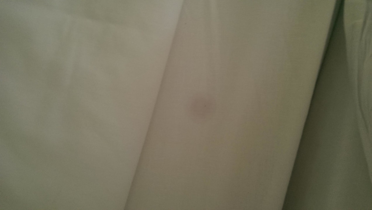 Flecken im Bett Tag 2 R2 Lago Playa Park