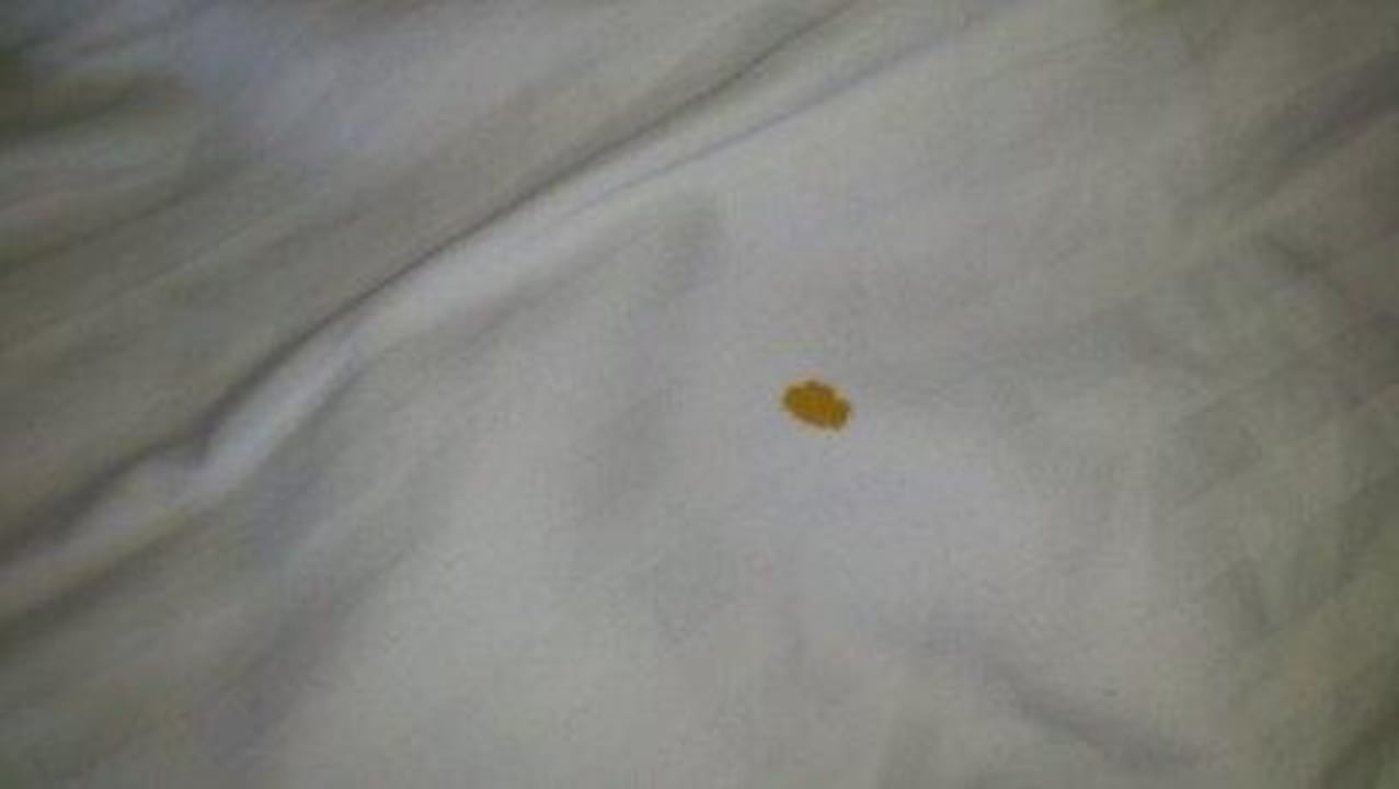 Alter Blutfleck auf Bettdecke The Tawana Bangkok