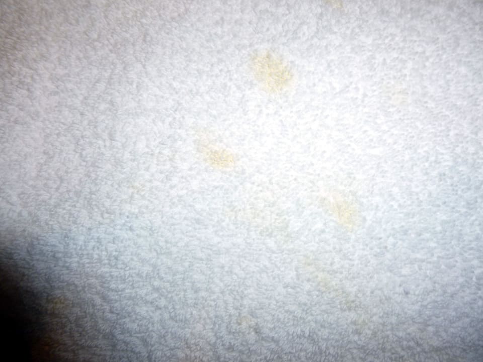 "Frisches" Handtuch mit Flecken Hotel Harbour Grand Hong Kong