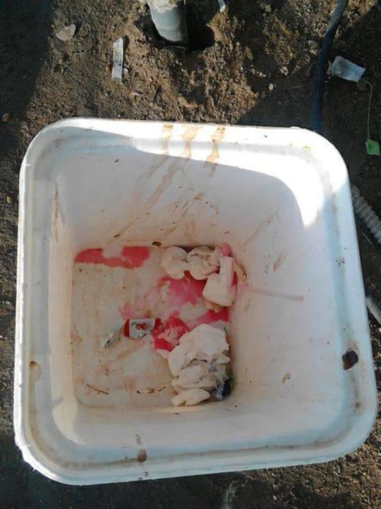 Verdreckte Mülleimer Jaz Aquaviva