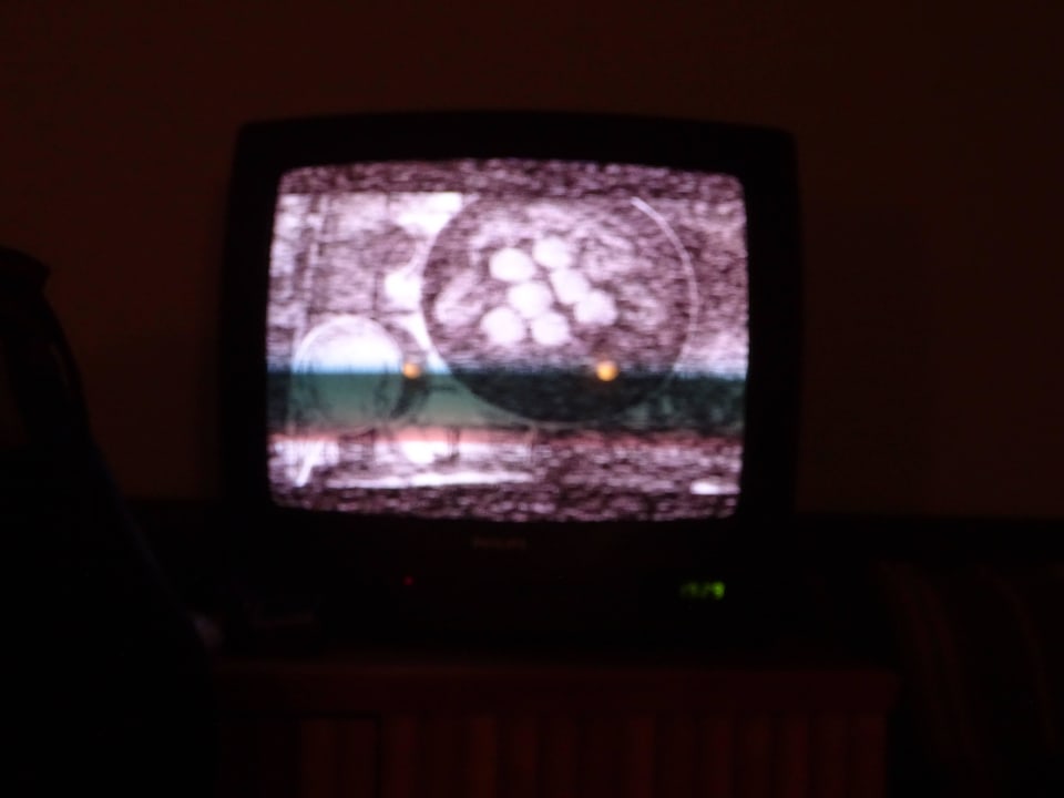 TV mit schlechter Qualität Terminal Hotel Köln