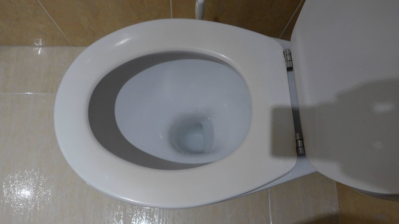 WC-Sitz schon braun gefärbt Universal Hotel Lido Park & Spa