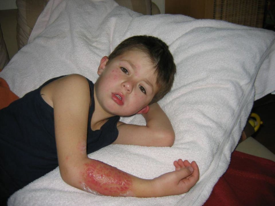 .. Folgen der Tätowierung bei unserem Sohn .. Jaz Makadi Oasis Resort