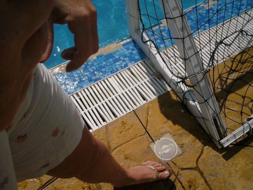 Verletzungsgefahr vor allem für Kinder Bella Vista Beach Club