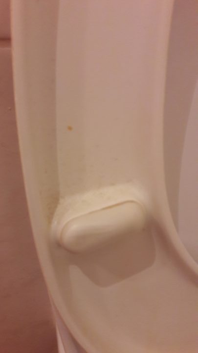 Klodeckel mit Fäkalrückständen  Hotel Traunerhof