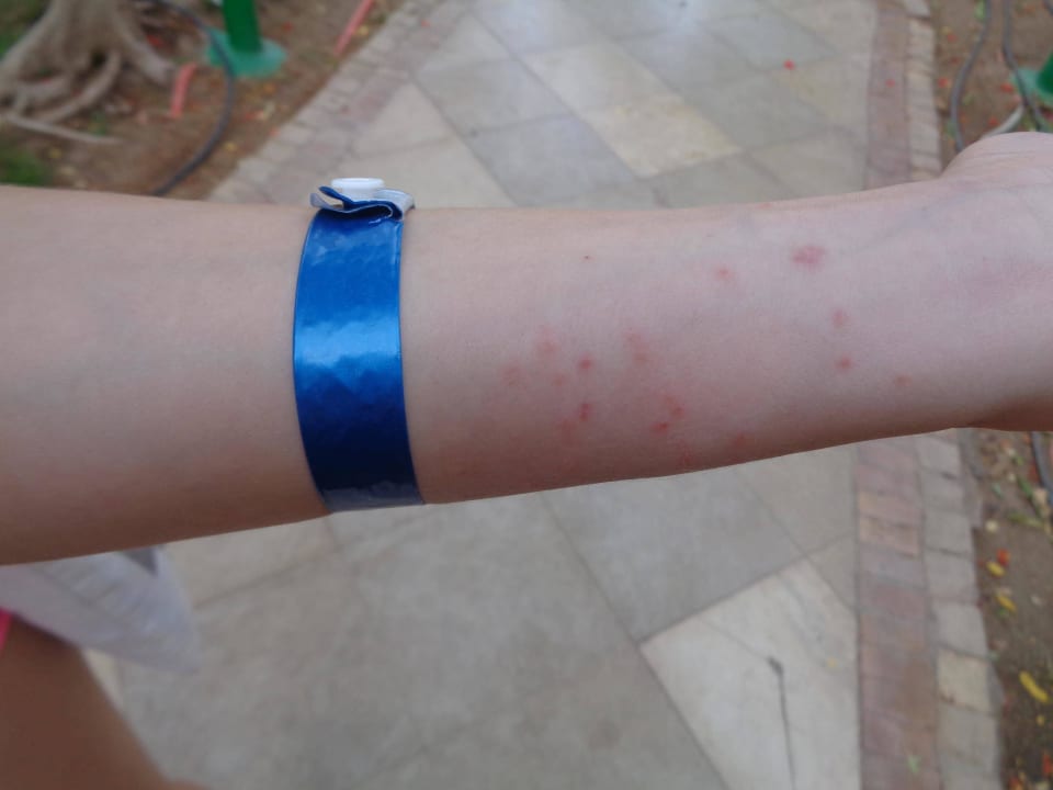 Укусы рубок The Grand Hotel Sharm El Sheikh