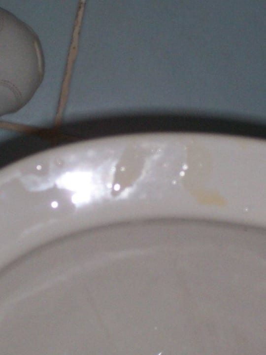 Vollgepinkelte Toilette Hotel Serra Park