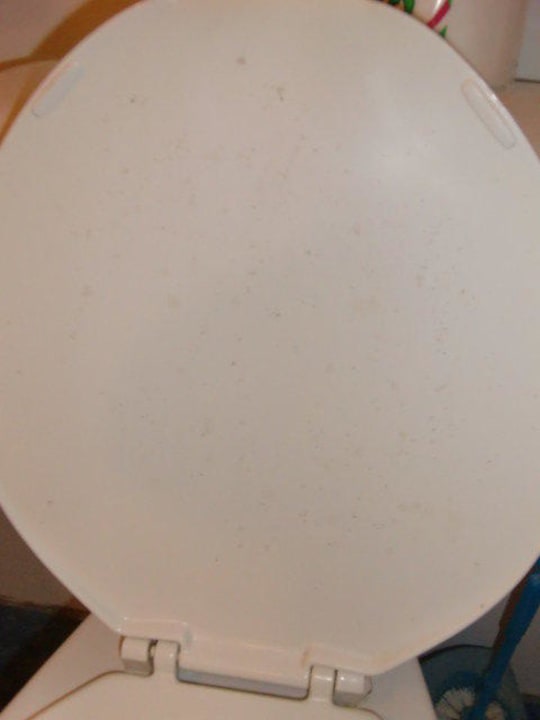 Hygiene sieht anders aus Charela Inn Hotel