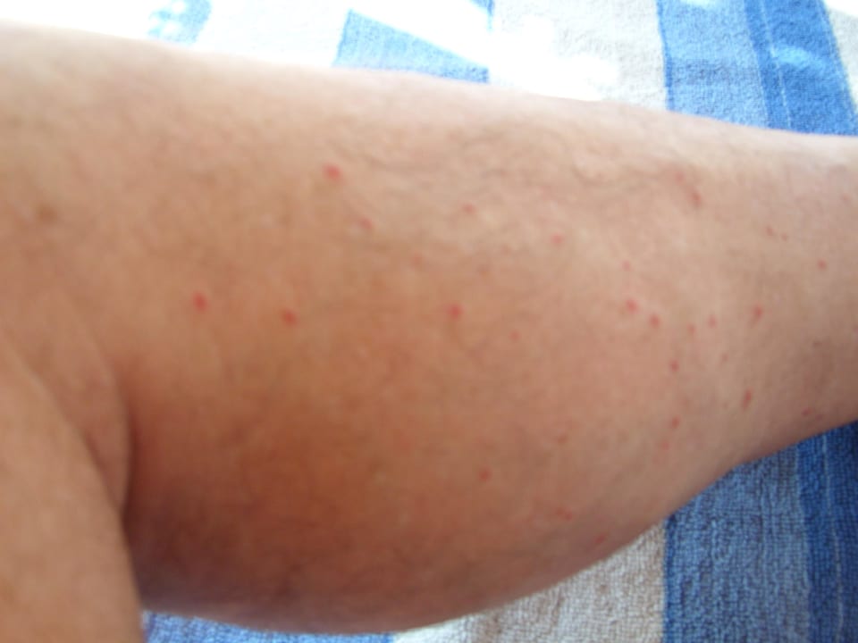 Flöhe waren unsere Untermieter Utopia Beach Club