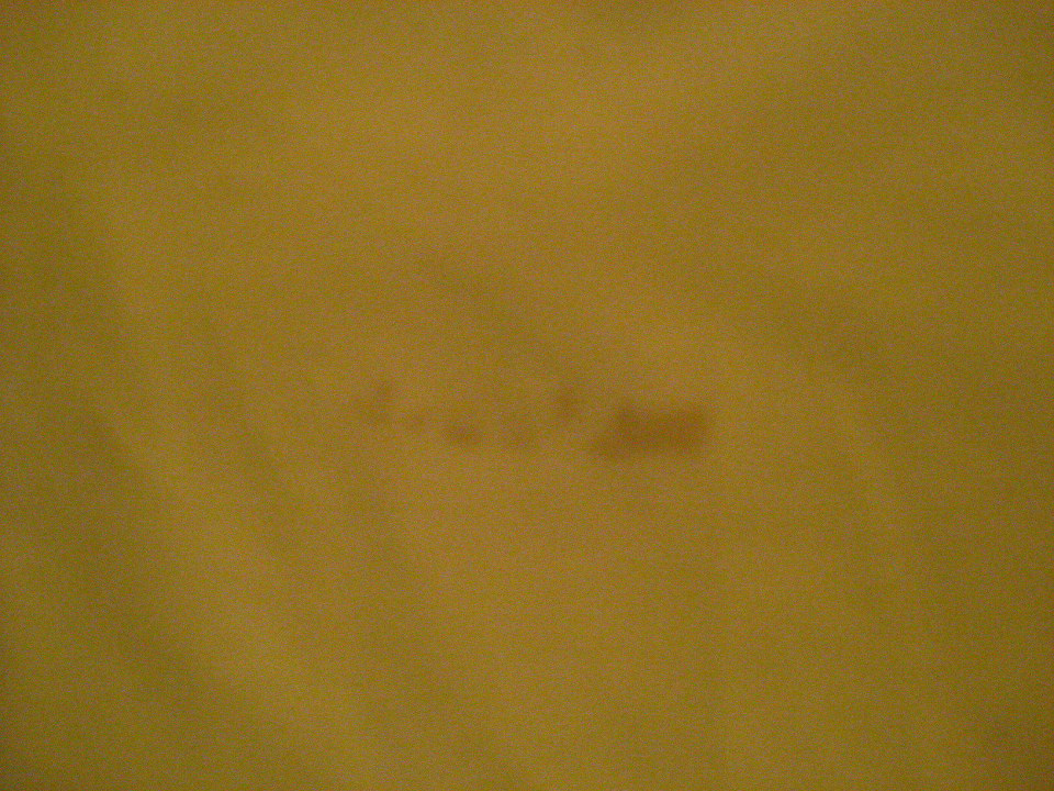Flecken in der Bettwäsche Sheraton Fuerteventura Golf & Spa Resort