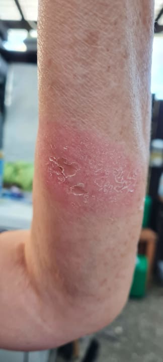 Zimmer Sunis Evren Beach Resort Hotel & Spa