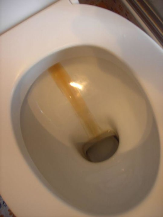 Verschmutzte Toilette Pension Carola