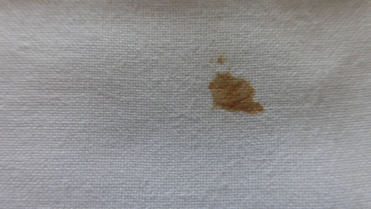 Blutflecken auf dem Bettlaken Hotel Vibra Beverly Playa