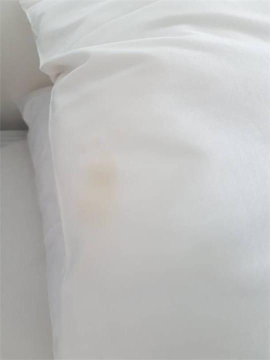 Stain on the pillow The Front Hotel