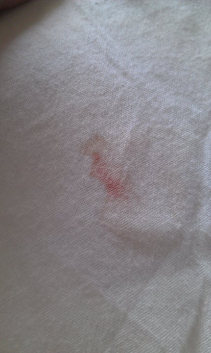 Flecken auf dem Bettlacken Hipotels Hipocampo Playa