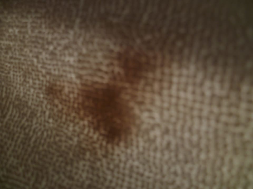 Hygenisch sehr bedenklich Hatipoglu Beach Hotel