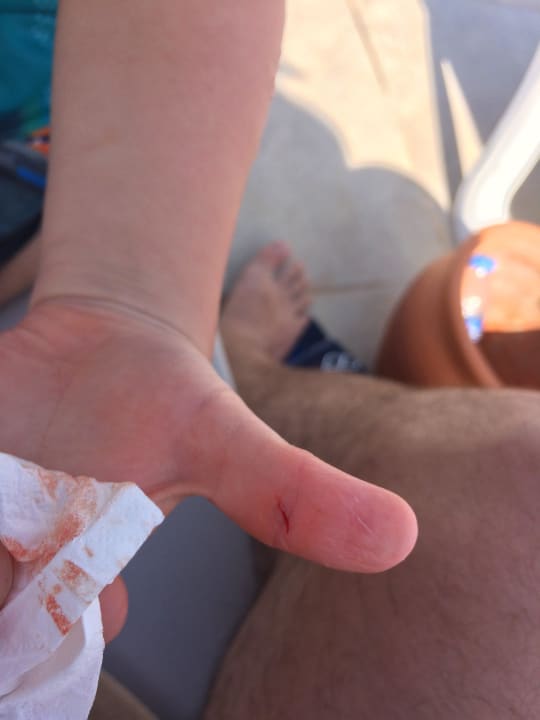 Wieder eine Schnittverletzung am Pool Maya World Park Hotel