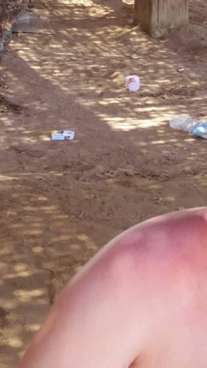 Wer mag sowas schon  Hotel Falcon Hills