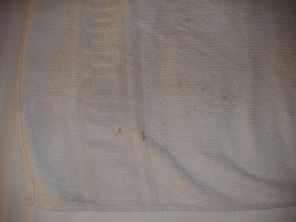 Gewaschene Handtücher mit Restschmutz FLOR los Almendros Hotel