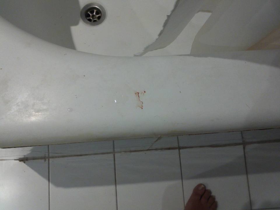 Blut, nach drei Tagen immer noch da  Hotel Nesrine